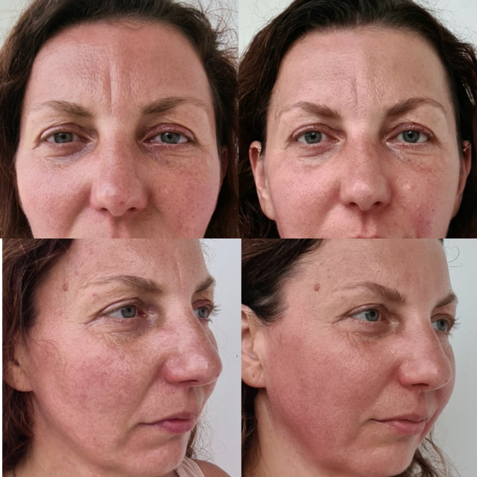 Obrazek posiada pusty atrybut alt; plik o nazwie 238683546_362364708665919_101112586652955792_n.jpg